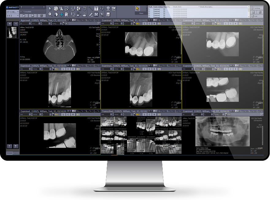 Dental Imaging Solutions | INFINITT North America